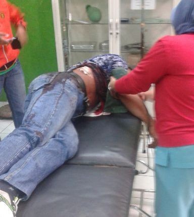 Salah satu korban penusukan bentrok antara Desa Pulau Pandan - Sanggaran Agung, Kamis (30/7) malam 